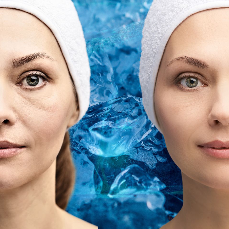 Cyto Cell Facial