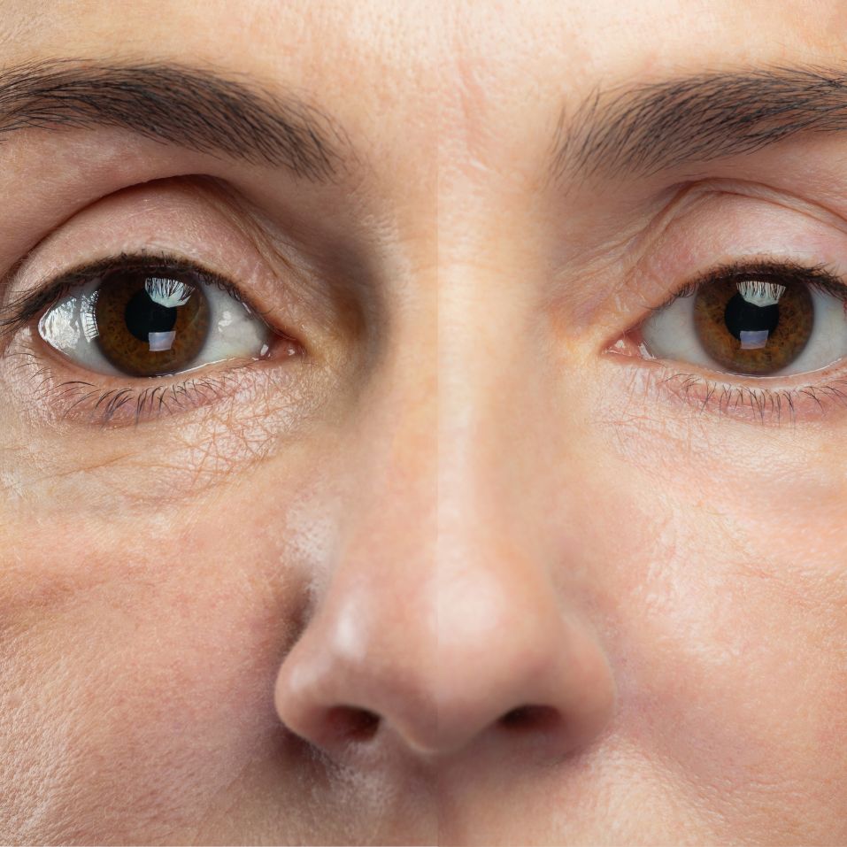 Pure Gold Eye Mask (2)